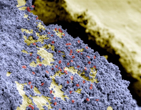 你看過(guò)這樣的嗎？顯微鏡下的口腔：這么恐怖
